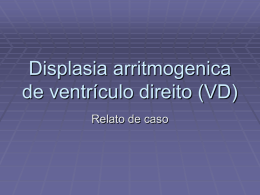 Displasia arritmogenica de ventrículo direito