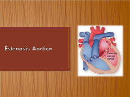 Estenosis_aortica