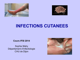INFECTIONS CUTANEES