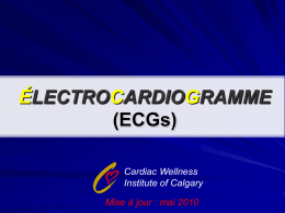 ÉLECTROCARDIOGRAMME (ECGs)