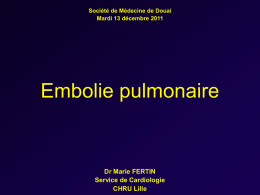 embolie pulmonaire - Société de Médecine de Douai