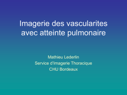 Imagerie des vascularites