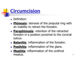 Circumcision & hypospadias Dr.Bilal Azzam