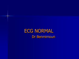 ECG normal