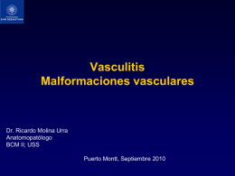 Vasculitis leucocitoclástica