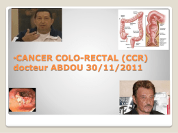 CANCER COLORECTAL Pwp