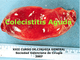 Manejo de la colecistitis aguda - Sociedad Valenciana de Cirugía