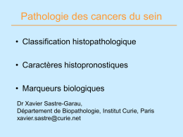 HER2 - Institut Pasteur