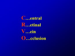 Central retinal vein cclusion